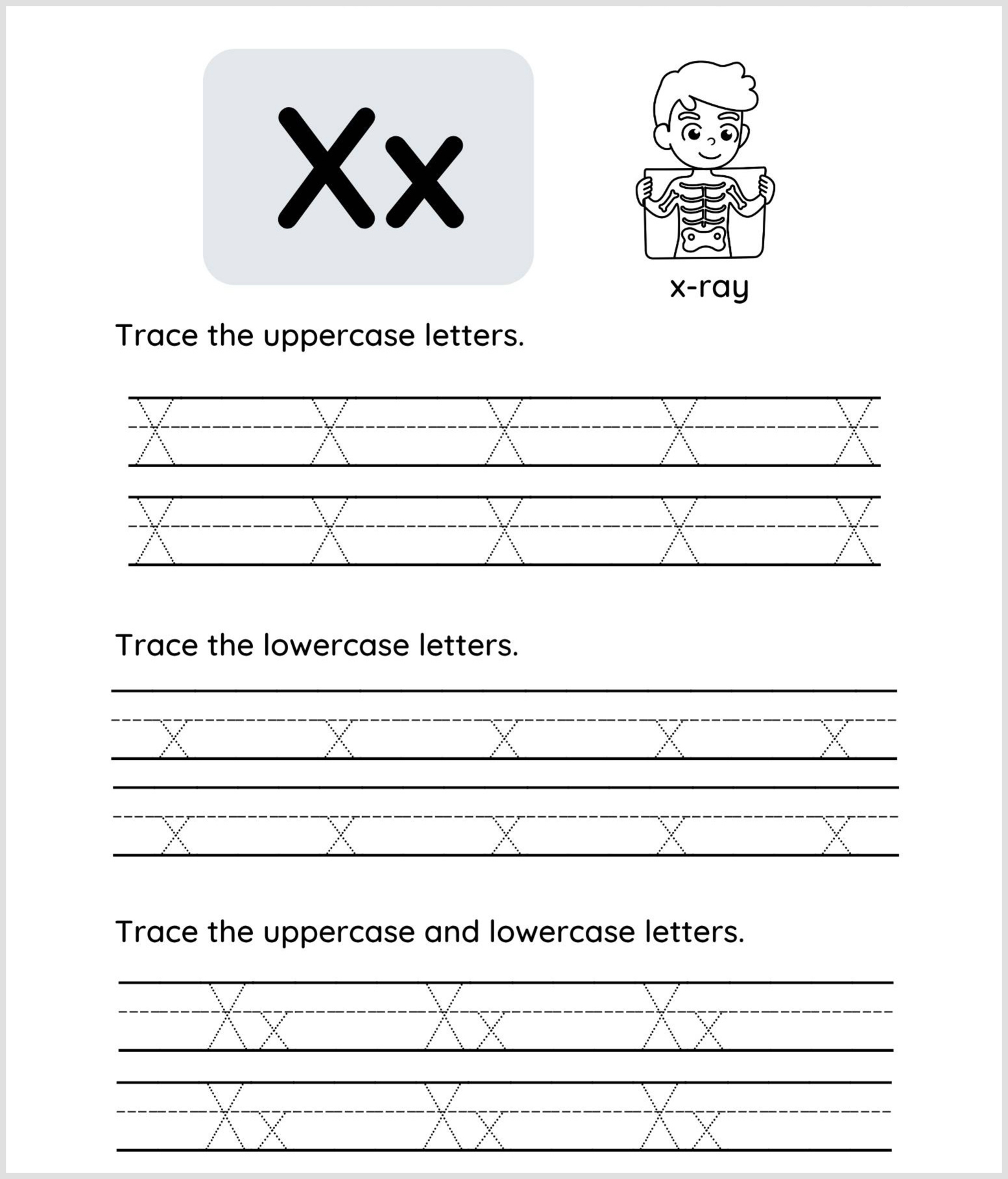 This Letter X tracing worksheet features uppercase and lowercase X, a cartoon child holding an x-ray, plus tracing lines for practicing writing both forms of the letter.