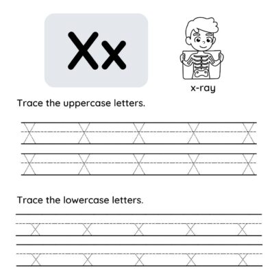 Letter X tracing worksheet: shows uppercase and lowercase X, a cartoon of a child holding an x-ray, and dotted lines for tracing uppercase and lowercase Xx.
